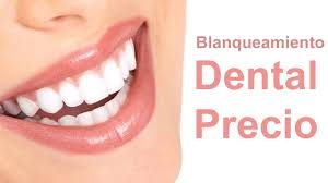 blanqueamiento-dental-precio